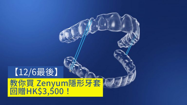 【12/6最後】教你買 Zenyum隱形牙套 回贈HK$3,500！